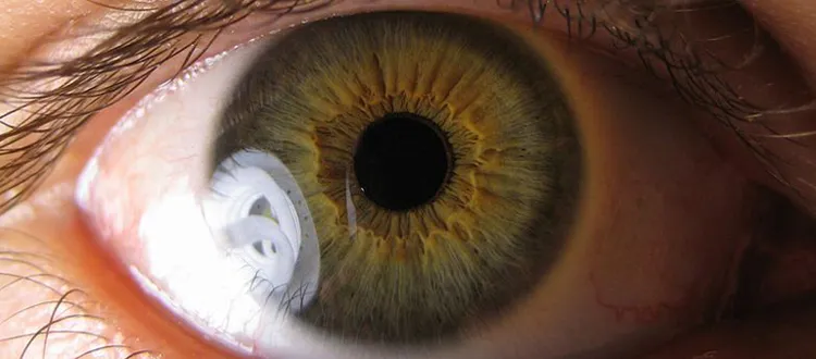 Detailed iris close-up showing unique multicolored pattern
