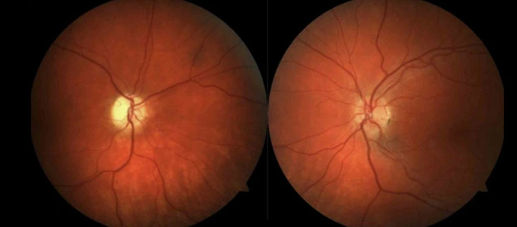 Clinical retinal fundus photography used for eye health evaluation